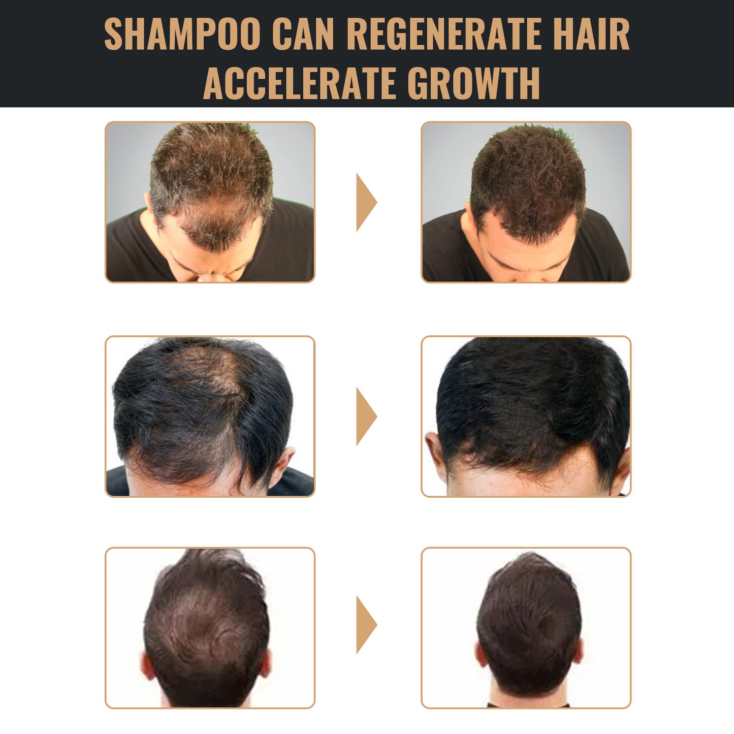 Oxlac Follicle Fuel
