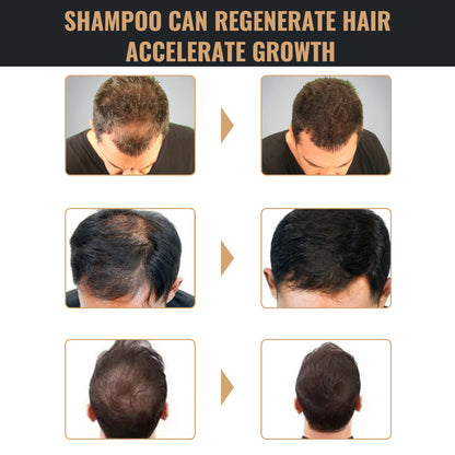 Oxlac Follicle Fuel
