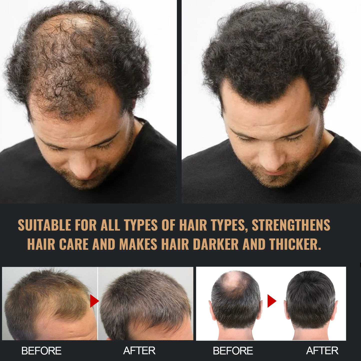Oxlac Follicle Fuel