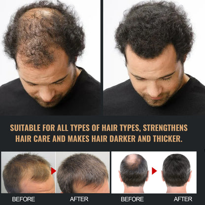 Oxlac Follicle Fuel